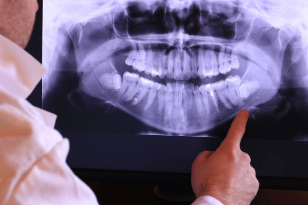 Best Broken or Cracked Tooth Emergency Dentist in Simonton Lake, IN